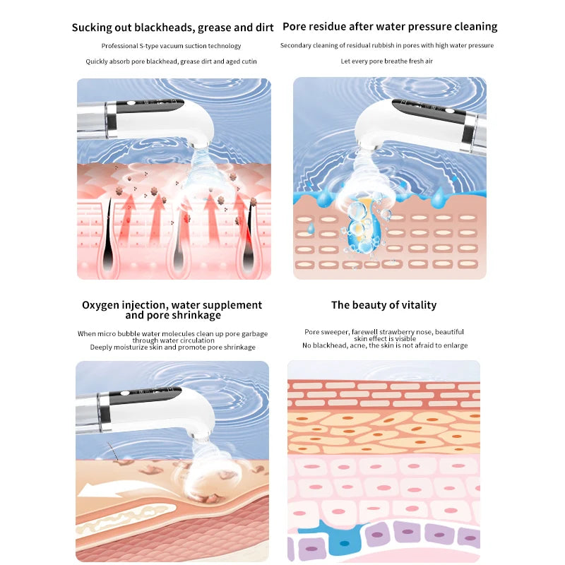 Blackhead Remover Vacuum Suction Water Cycle Pore Acne Cleaner USB Rechargeable Black Head Removal  Face Cleaner