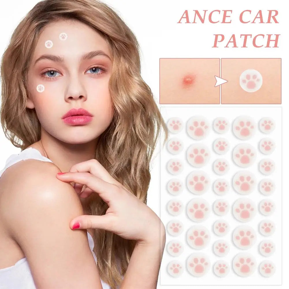 Hydrocolloid Acne Pimple Patch 36 Counts Cute Cat Paws Shaped Acne Absorbing Cover Patch, Invisible For Acne Dots