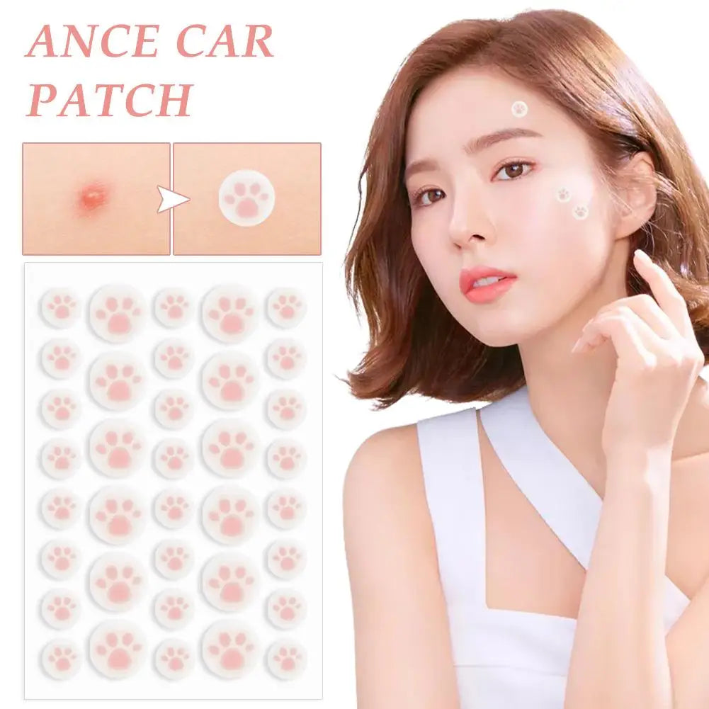 Hydrocolloid Acne Pimple Patch 36 Counts Cute Cat Paws Shaped Acne Absorbing Cover Patch, Invisible For Acne Dots