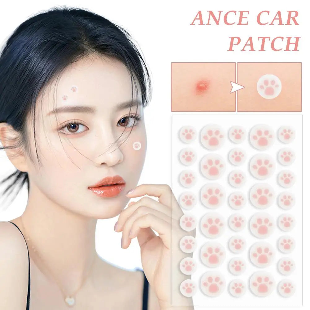 Hydrocolloid Acne Pimple Patch 36 Counts Cute Cat Paws Shaped Acne Absorbing Cover Patch, Invisible For Acne Dots