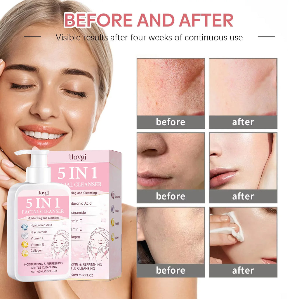 5 in 1 Moisturizing Facial Cleanser Refreshed Cleansing Makeup Remover Brightening Hydrating Light Texture Rich Foam Cleanser